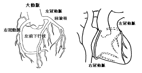 虚血性心疾患